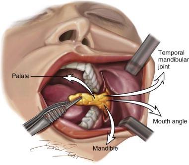 Harmonização Orofacial