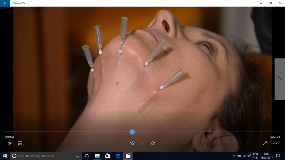 Harmonização Orofacial