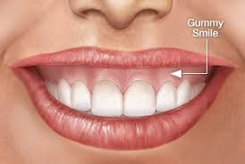 Harmonização Orofacial